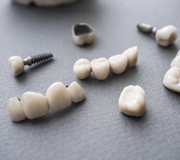 San Lorenzo The Difference Between Dental Implants and Mini Dental Implants