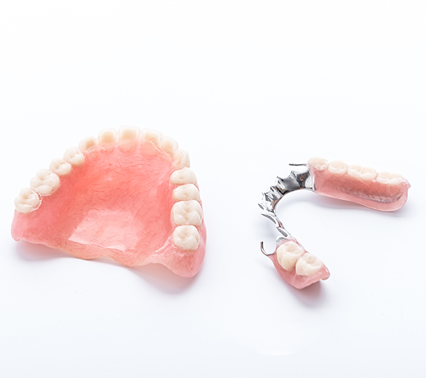 San Lorenzo Partial Dentures for Back Teeth